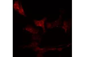 ABIN6276467 staining  HeLa cells by IF/ICC. (IRF4 抗体  (C-Term))