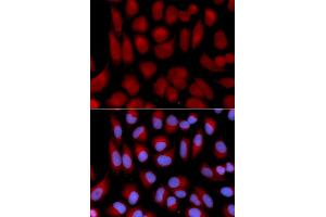 Immunofluorescence analysis of U2OS cells using TAP2 antibody.
