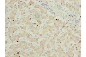 Immunohistochemistry of paraffin-embedded human liver tissue using ABIN7144733 at dilution of 1:100 (GOT2 抗体  (AA 33-279))