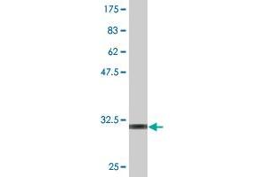 Western Blot detection against Immunogen (32. (KAT2B 抗体  (AA 367-432))