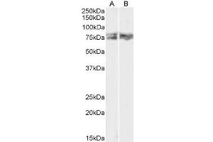 ABIN5539550 (1µg/ml) staining of HeLa (A) and NIH3T3 (B) lysate (35µg protein in RIPA buffer). (LIMK2 抗体  (AA 181-193))