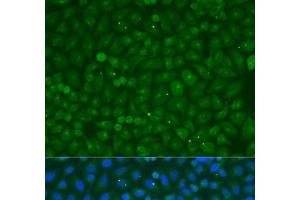 Immunofluorescence analysis of U2OS cells using COG4 Polyclonal Antibody at dilution of 1:100. (COG4 抗体)