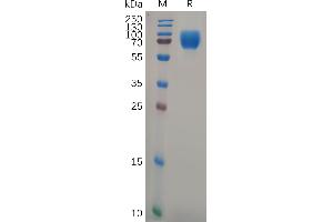 SDS-PAGE (SDS) image for Growth Hormone Receptor (GHR) (AA 27-264) protein (Fc Tag) (ABIN7092794)