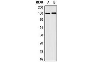 Western blot analysis of CD131 (pY593) expression in MCF7 IL1b-treated (A), HepG2 LPS-treated (B) whole cell lysates. (CD131 抗体  (pTyr593))
