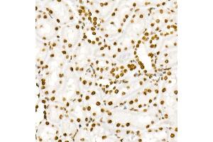 Immunohistochemistry (IHC) image for anti-Signal Transducer and Activator of Transcription 3 (Acute-Phase Response Factor) (STAT3) (pTyr705) antibody (ABIN6136266)