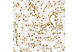 Immunohistochemistry of paraffin-embedded rat kidney using Phospho-ST-Y705 Rabbit mAb (ABIN6135325, ABIN6136266, ABIN6136267 and ABIN7101883) at dilution of 1:100 (40x lens). (STAT3 抗体  (pTyr705))