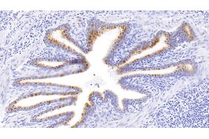 Detection of MMP2 in Human Lung Tissue using Polyclonal Antibody to Matrix Metalloproteinase 2 (MMP2) (MMP2 抗体  (AA 445-660))