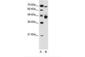 Image no. 1 for anti-Nuclear Receptor Subfamily 2, Group F, Member 6 (NR2F6) (AA 21-70) antibody (ABIN6736681)