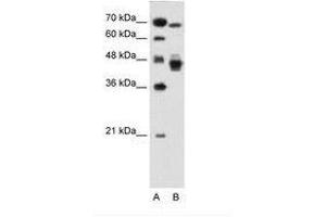 Image no. 1 for anti-Nuclear Receptor Subfamily 2, Group F, Member 6 (NR2F6) (AA 21-70) antibody (ABIN6736681) (NR2F6 抗体  (AA 21-70))