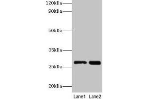 Western blot All lanes: LGALS3 antibody at 2 μg/mL Lane 1: Hela whole cell lysate Lane 2: MCF-7 whole cell lysate Secondary Goat polyclonal to rabbit IgG at 1/10000 dilution Predicted band size: 27 kDa Observed band size: 27 kDa (Galectin 3 抗体  (AA 2-250))