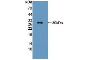 Western blot analysis of recombinant Rat LAG3. (LAG3 抗体  (AA 209-451))