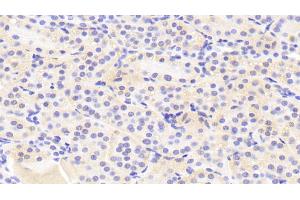 Detection of GTF2H5 in Human Kidney Tissue using Polyclonal Antibody to General Transcription Factor IIH, Polypeptide 5 (GTF2H5) (GTF2H5 抗体  (AA 1-71))