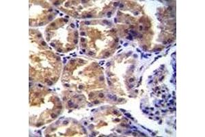 Immunohistochemistry (IHC) image for anti-Transient Receptor Potential Cation Channel, Subfamily M, Member 6 (TRPM6) (AA 317-348) antibody (ABIN3029237)