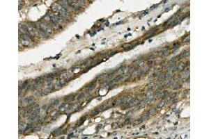 IHC analysis of FABP6 using anti-FABP6 antibody (ABIN7598974). (FABP6 抗体  (AA 1-128))