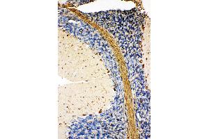 Anti-GRP78 BiP antibody, IHC(P) IHC(P): Rat Cerebellum Tissue