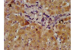 Immunohistochemistry (IHC) image for anti-Dimethylglycine Dehydrogenase (DMGDH) (AA 429-524) antibody (ABIN7149966)