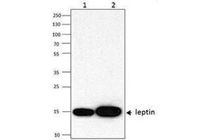 Western Blotting (WB) image for anti-Leptin (LEP) antibody (ABIN2665227) (Leptin 抗体)