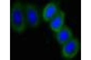 Immunofluorescent analysis of HepG2 cells using ABIN7169807 at dilution of 1:100 and Alexa Fluor 488-congugated AffiniPure Goat Anti-Rabbit IgG(H+L) (SLITRK6 抗体  (AA 621-821))