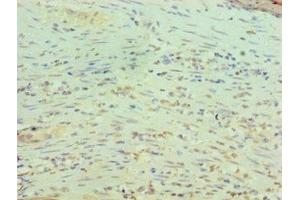Immunohistochemistry of paraffin-embedded human epityphlon tissue using ABIN7167786 at dilution of 1:100 (RBBP5 抗体  (AA 319-538))