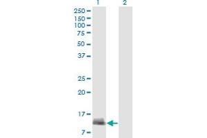 Western Blot analysis of CARD17 expression in transfected 293T cell line by CARD17 monoclonal antibody (M01A), clone 1G6. (CARD17 抗体  (AA 1-110))