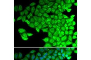 Immunofluorescence analysis of HeLa cells using MYL2 Polyclonal Antibody (MYL2 抗体)