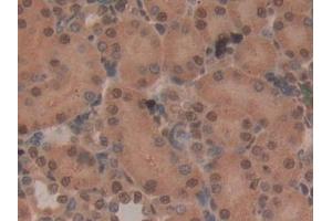 Detection of CD2AP in Rat Kidney Tissue using Polyclonal Antibody to CD2 Associated Protein (CD2AP)