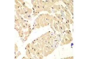 Immunohistochemistry of paraffin-embedded mouse heart using HIF1AN antibody.