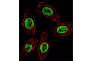 Immunofluorescent staining of U251 cell reacted with EZH2 monoclonal antibody  at 1:10-1:50 dilution. (EZH2 抗体)