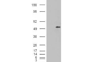 Image no. 2 for anti-STEAP Family Member 4 (STEAP4) (C-Term) antibody (ABIN375107) (STEAP4 抗体  (C-Term))