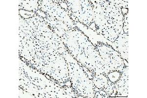 IHC analysis of MCM6 using anti-MCM6 antibody (ABIN7600037). (MCM6 抗体  (AA 14-821))