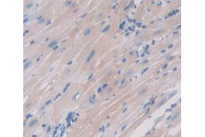 IHC-P analysis of Human Tissue, with DAB staining. (TNNC1 抗体  (AA 1-161))
