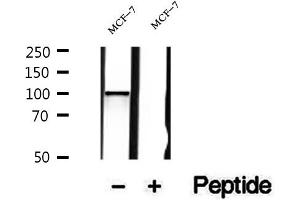 Western Blotting (WB) image for anti-Solute Carrier Family 39 (Zinc Transporter), Member 6 (SLC39A6) (Internal Region) antibody (ABIN6262982)
