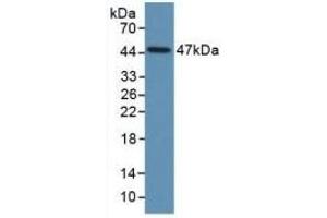 Detection of Recombinant PAI1, Human using Monoclonal Antibody to Plasminogen Activator Inhibitor 1 (PAI1) (PAI1 抗体)