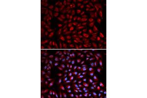 Immunofluorescence analysis of U2OS cell using RARA antibody.