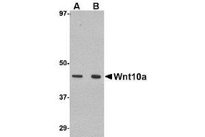 Image no. 1 for anti-Wingless-Type MMTV Integration Site Family, Member 10A (WNT10A) (C-Term) antibody (ABIN1492215) (WNT10A 抗体  (C-Term))