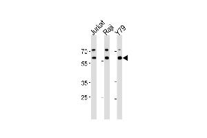 Western blot analysis in Jurkat,Raji,Y79 cell line lysates (35ug/lane). (Acetylcholinesterase 抗体  (N-Term))