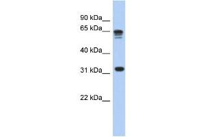 WB Suggested Anti-RPS3A Antibody Titration: 0. (RPS3A 抗体  (N-Term))