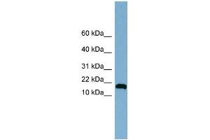 WB Suggested Anti-ANKRD37 Antibody Titration: 0. (ANKRD37 抗体  (Middle Region))