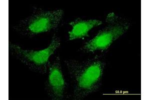 Immunofluorescence of monoclonal antibody to TOP3B on HeLa cell. (TOP3B 抗体  (AA 1-862))