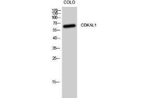 Western Blotting (WB) image for anti-CDK5 Regulatory Subunit Associated Protein 1-Like 1 (CDKAL1) (N-Term) antibody (ABIN3174325) (CDKAL1 抗体  (N-Term))