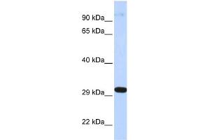 WB Suggested Anti-ZNF688 Antibody Titration:  0. (ZNF688 抗体  (Middle Region))