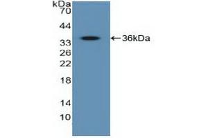 Western blot analysis of recombinant Human IGF2R. (IGF2R 抗体  (AA 2167-2442))