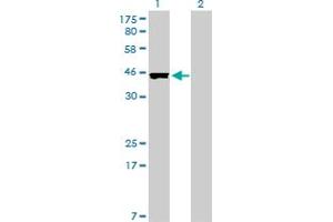 Western Blot analysis of CREB3L4 expression in transfected 293T cell line by CREB3L4 monoclonal antibody (M01), clone 3E3. (CREB3L4 抗体  (AA 1-110))