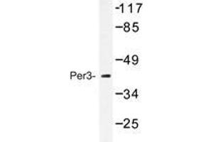 Western blot analysis of Per3 antibody in extracts from Jurkat cells treated with insulin 0. (PER3 抗体)