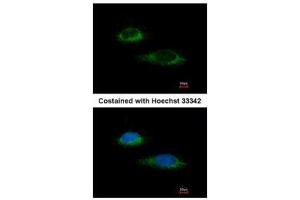 ICC/IF Image Immunofluorescence analysis of methanol-fixed HeLa, using Glutamate Dehydrogenase, antibody at 1:100 dilution. (GLUD1 抗体)