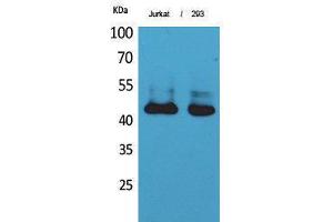 Western Blotting (WB) image for anti-SCCA1/2 (Internal Region) antibody (ABIN3181018) (SCCA1/2 (Internal Region) 抗体)