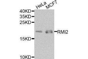 Western blot analysis of extracts of HeLa and MCF7 cells, using RMI2 antibody. (RMI2 抗体)