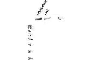 Western Blotting (WB) image for anti-Ataxia Telangiectasia Mutated (ATM) (Ser159) antibody (ABIN3183427) (ATM 抗体  (Ser159))