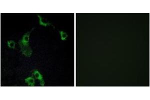 Immunofluorescence analysis of COS7 cells, using CIDEB Antibody. (CIDEB 抗体  (AA 91-140))