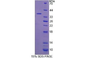 SDS-PAGE analysis of Mouse CANT1 Protein. (CANT1 蛋白)